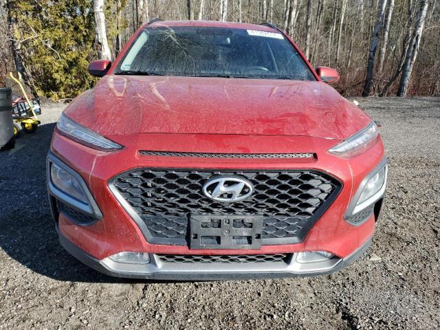 2018 Hyundai Kona Sel - Image 5