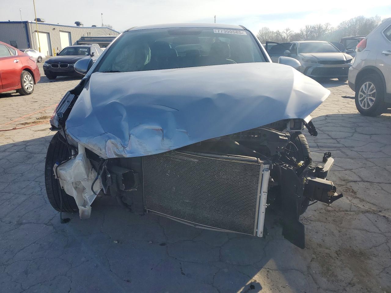 2017 Hyundai Elantra Se - Фото 5