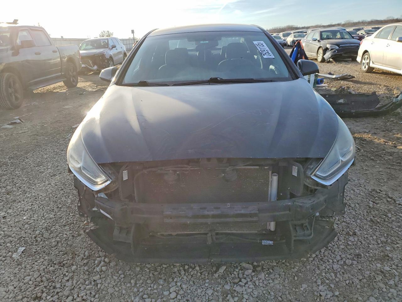 2018 Hyundai Sonata Se - Фото 5