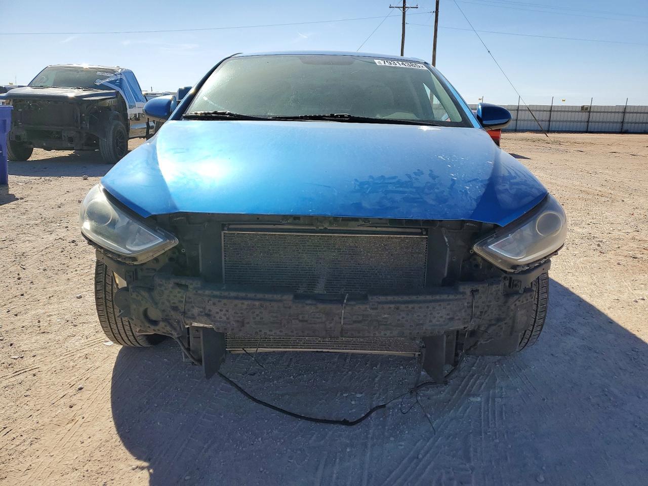 2017 Hyundai Elantra Se - Image 5