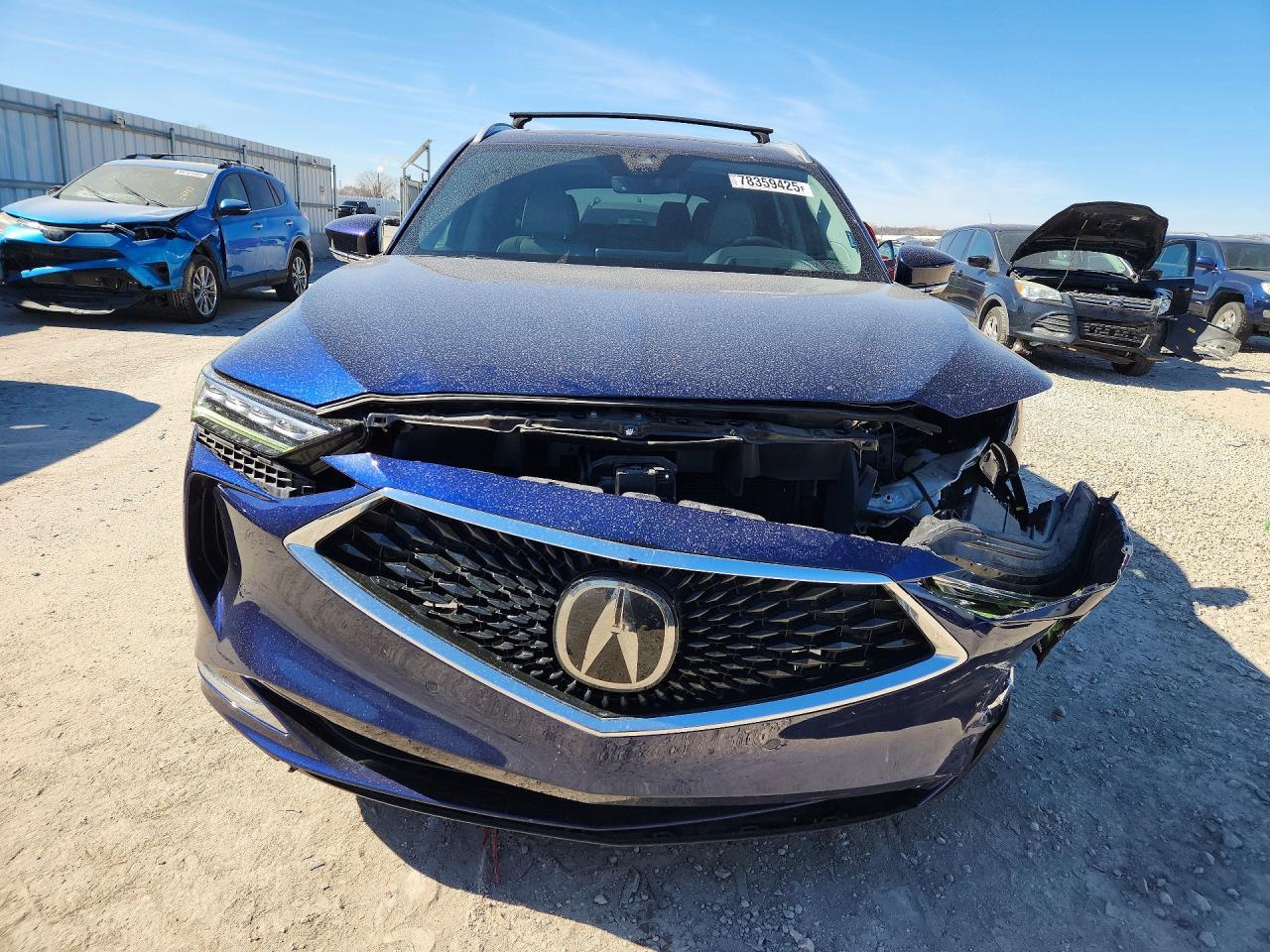 2022 Acura Mdx Advance - Фото 5