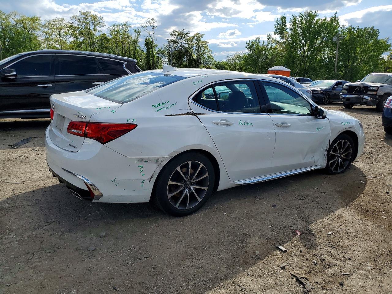 2018 Acura Tlx Tech - Фото 3