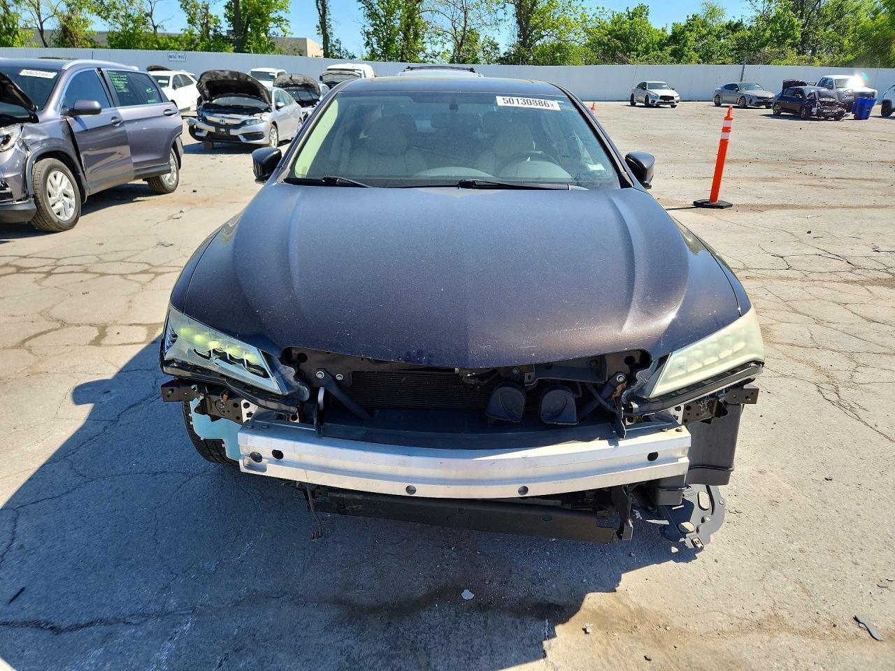 2015 Acura Tlx - Image 5