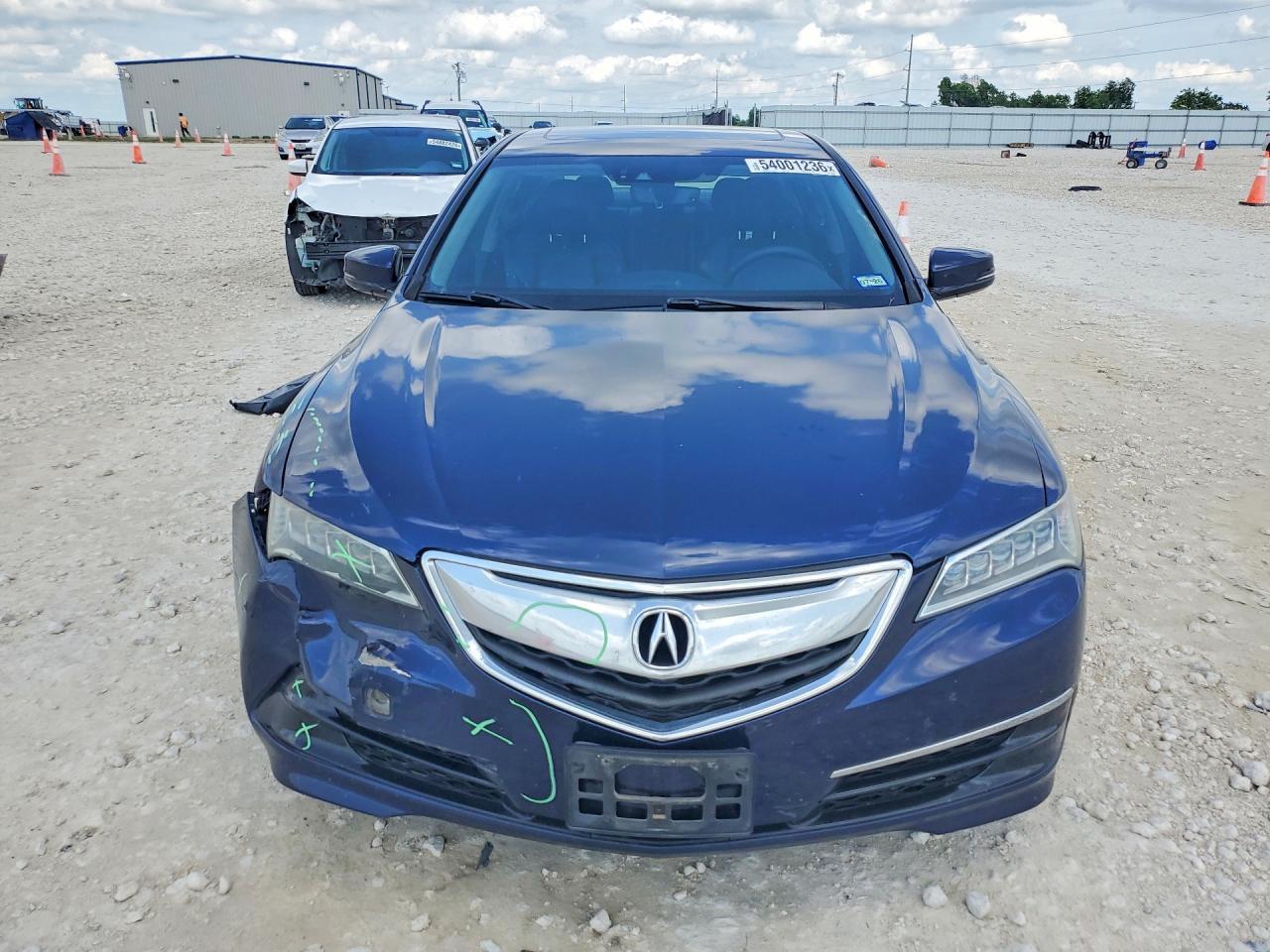 2017 Acura Tlx - Фото 5