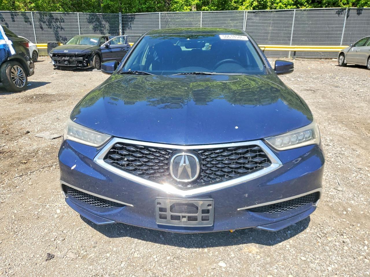 2018 Acura Tlx - Фото 5