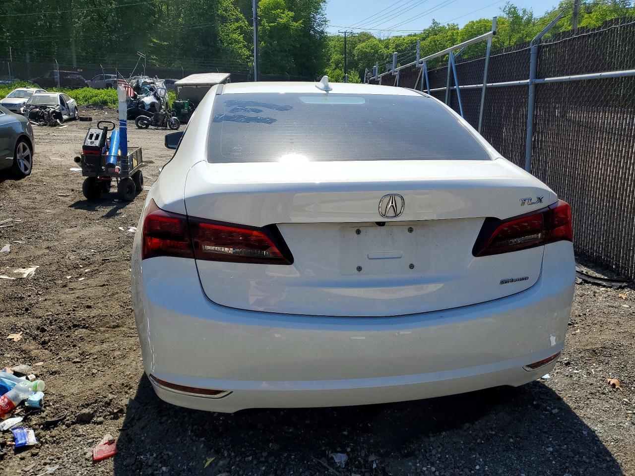2017 Acura Tlx - Фото 6