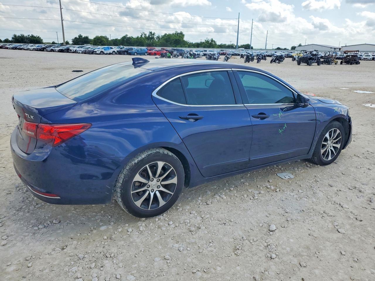 2017 Acura Tlx - Фото 3
