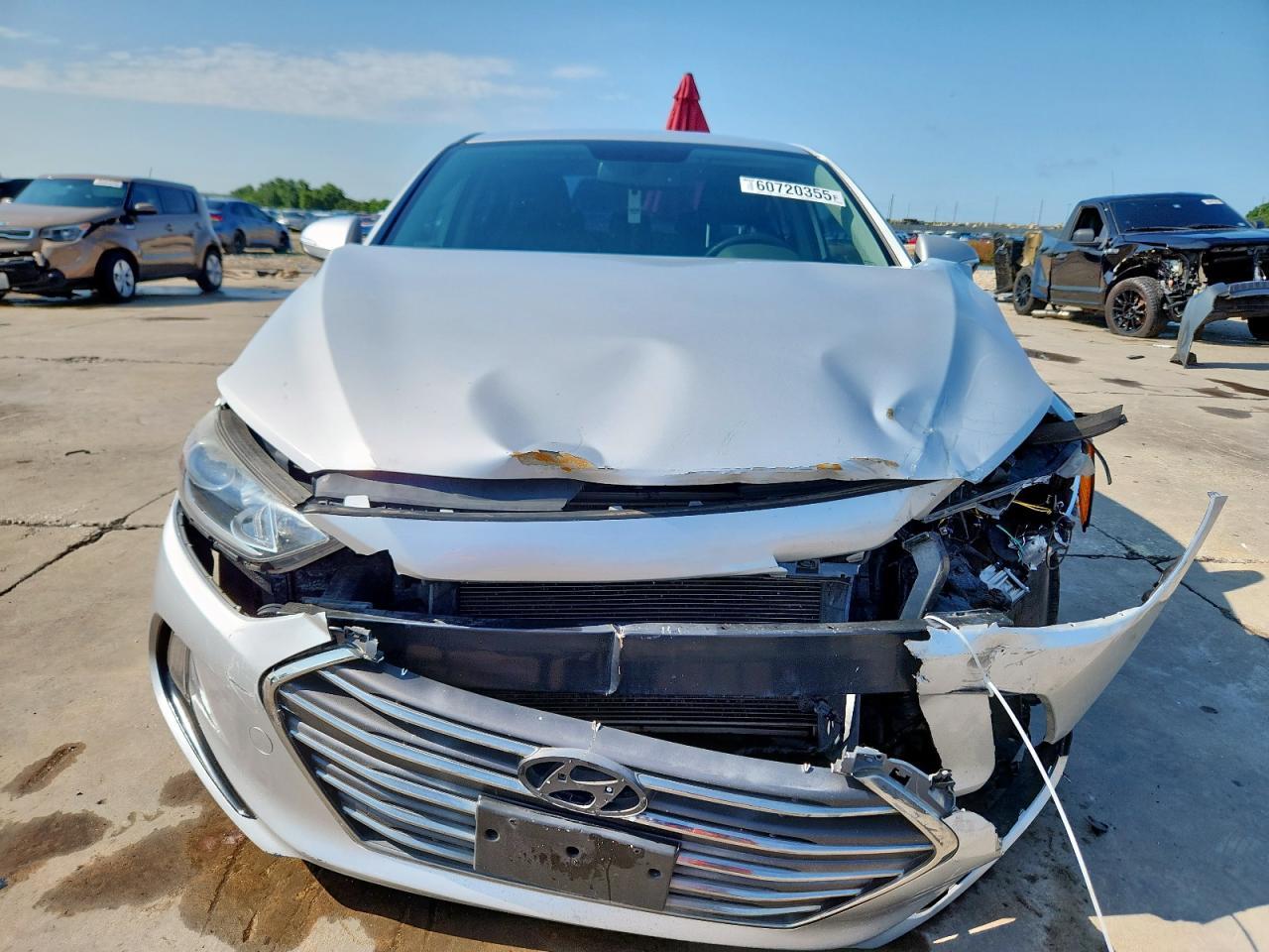 2017 Hyundai Elantra Se - Фото 5