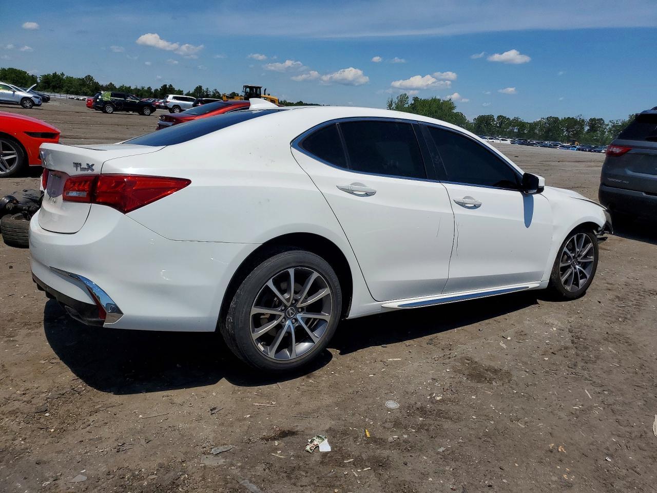 2018 Acura Tlx Tech - Фото 3