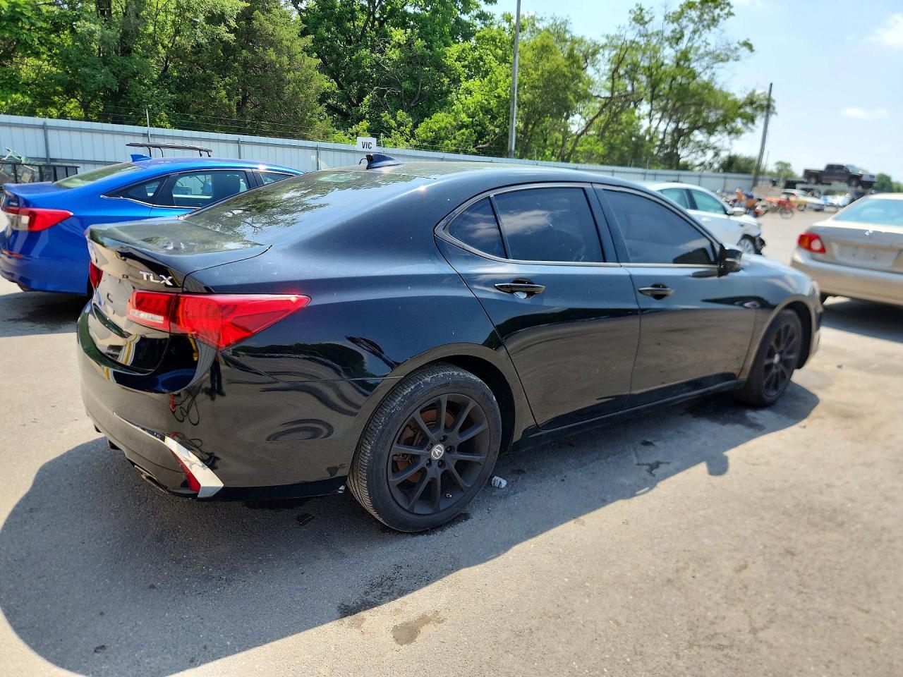 2018 Acura Tlx - Фото 3