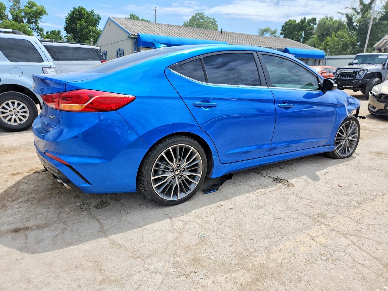 2017 Hyundai Elantra Sport - Фото 3