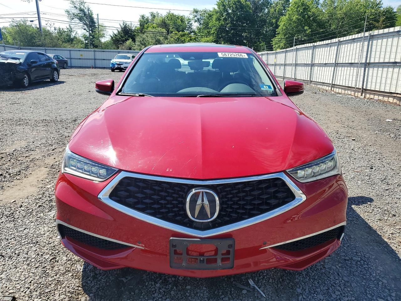 2018 Acura Tlx - Фото 5
