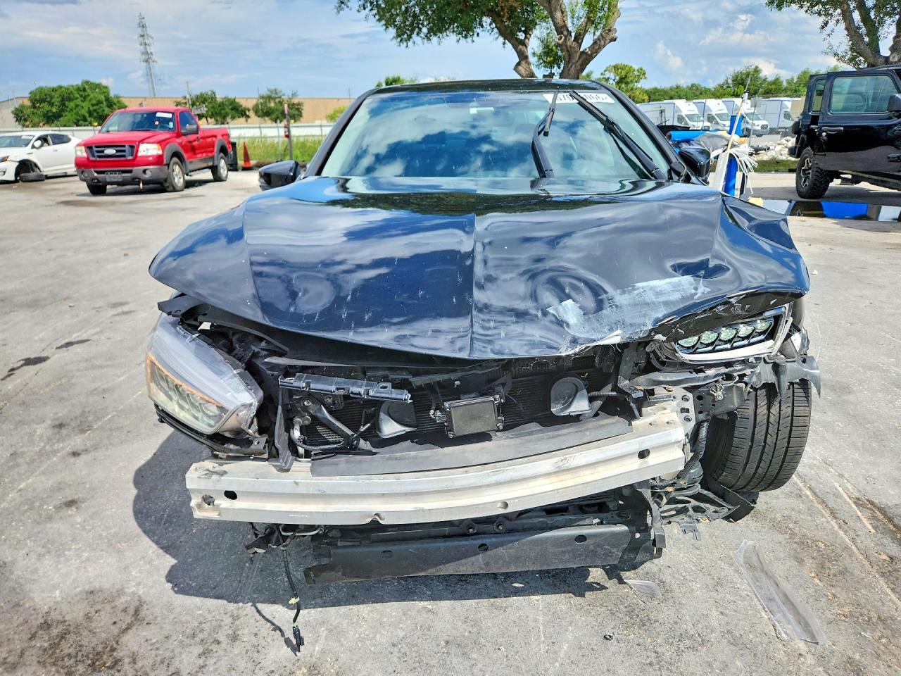 2018 Acura Tlx - Фото 5