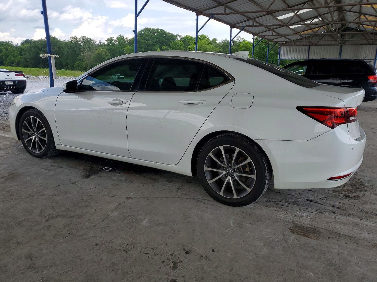 2015 Acura Tlx Advance - Фото 2