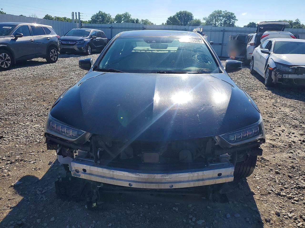 2018 Acura Tlx - Фото 5