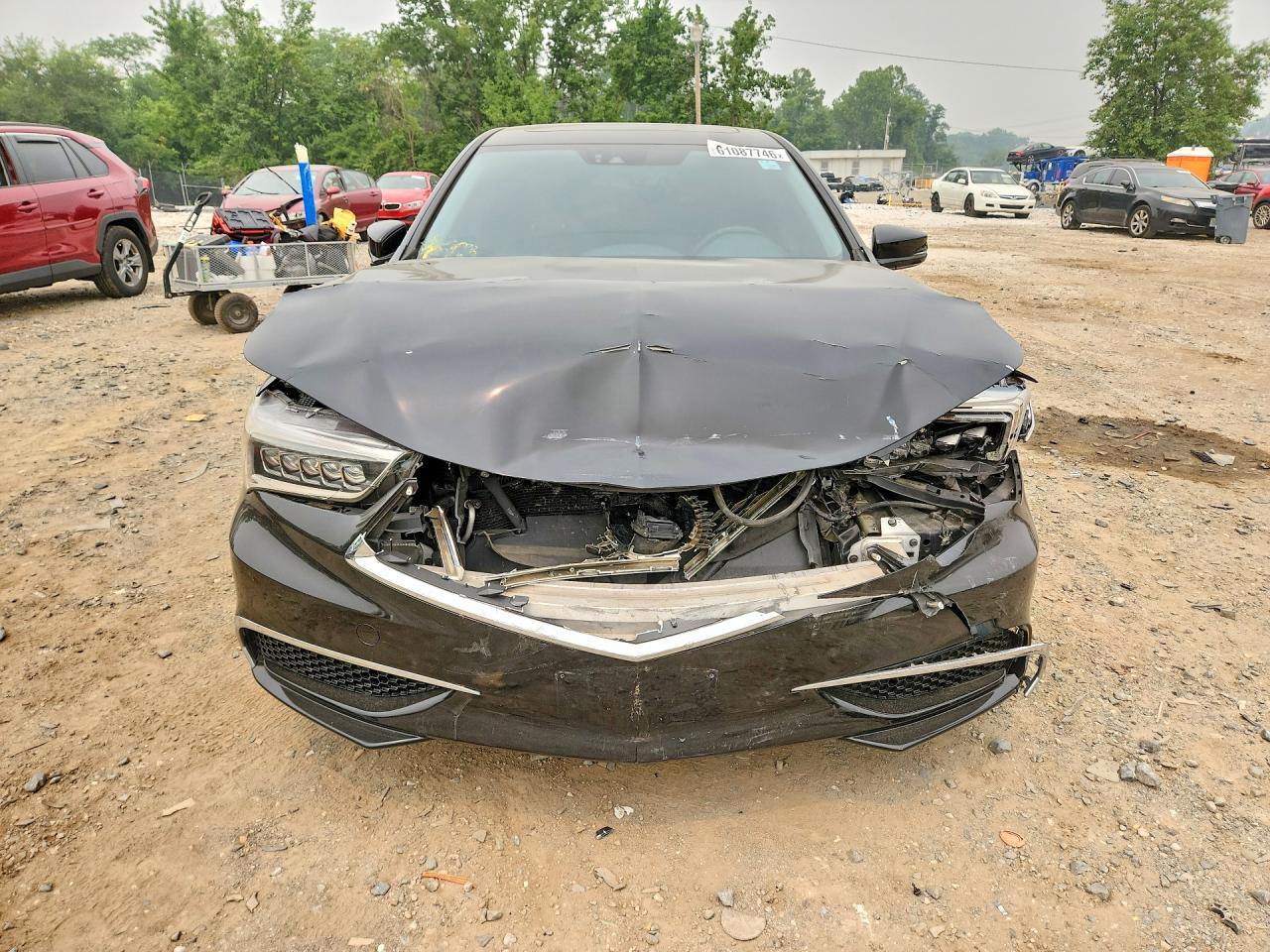 2018 Acura Tlx - Image 5