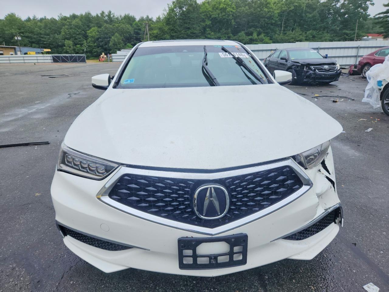 2018 Acura Tlx - Фото 5