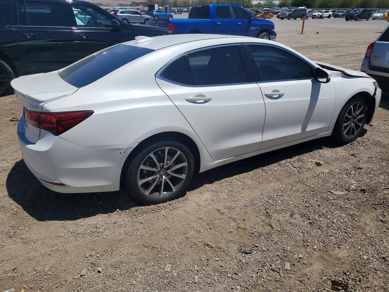 2015 Acura Tlx Advance - Фото 3