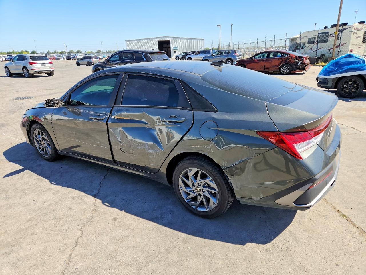 2024 Hyundai Elantra Blue - Фото 2