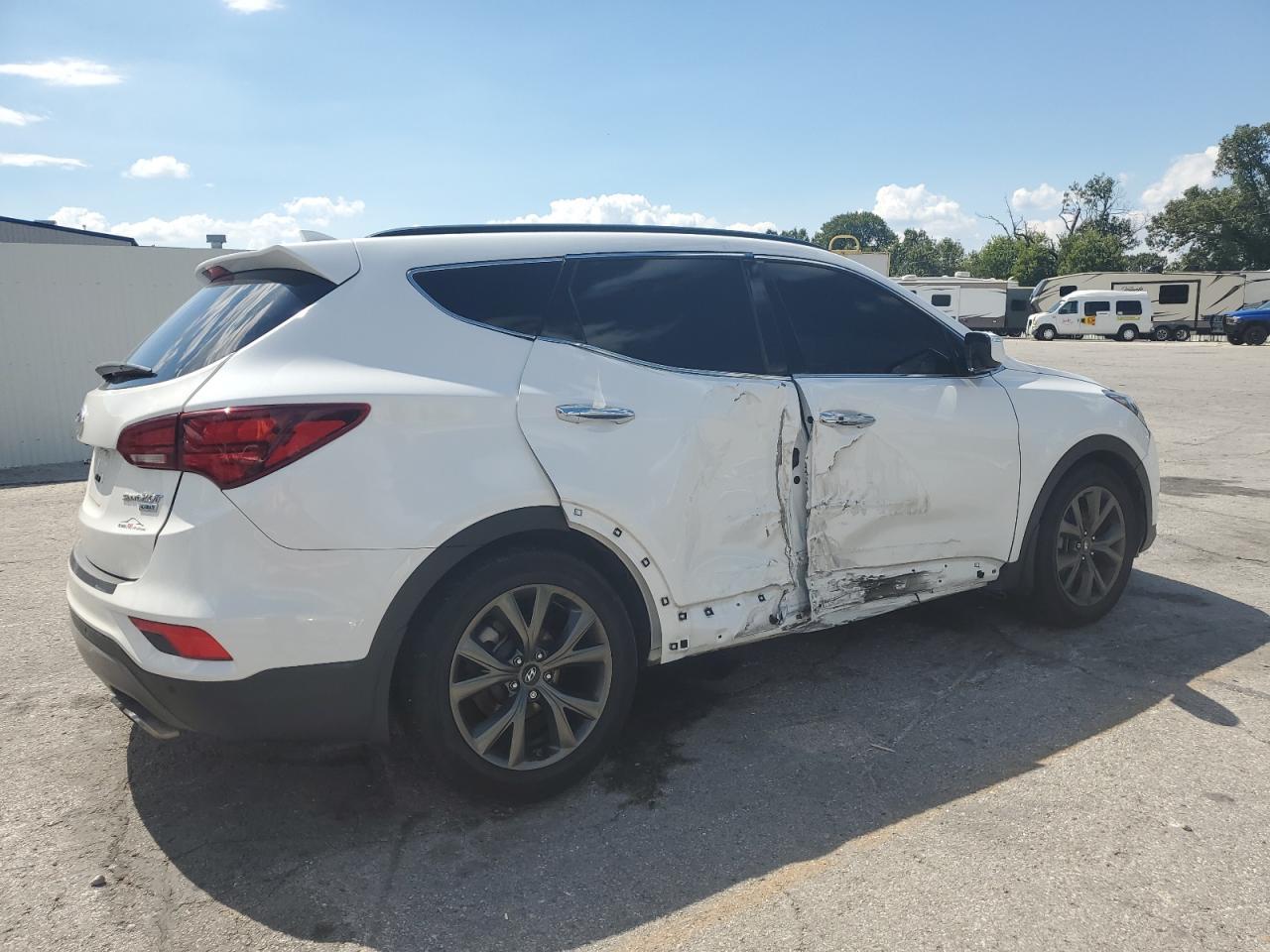 2017 Hyundai Santa Fe Sport 2.0T Ultimate - Фото 3