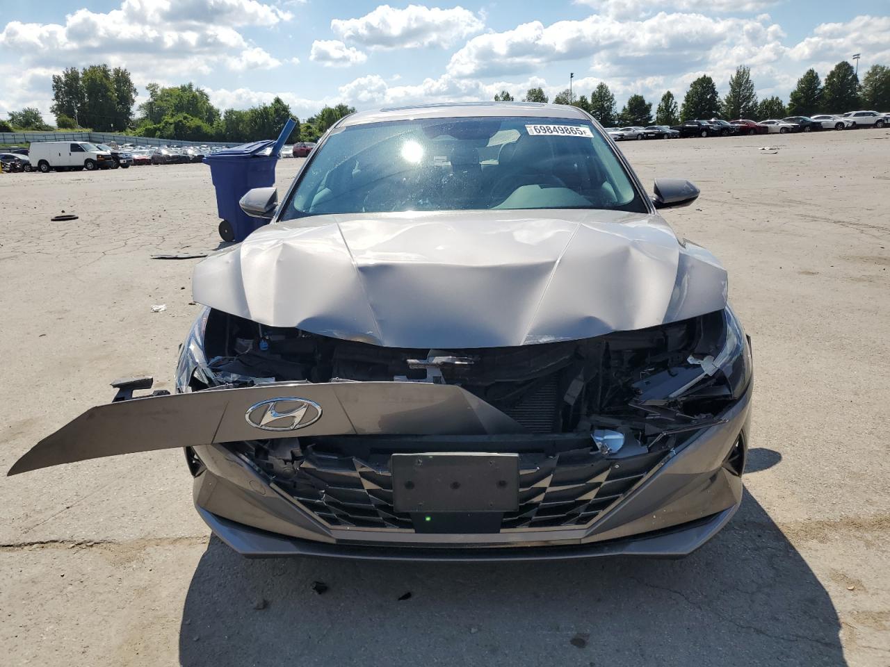 2022 Hyundai Elantra Limited - Image 5