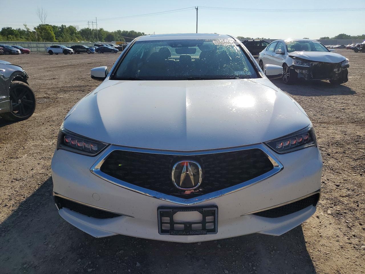 2018 Acura Tlx Tech - Фото 5