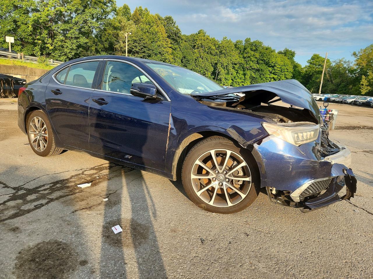 2020 Acura Tlx - Фото 4