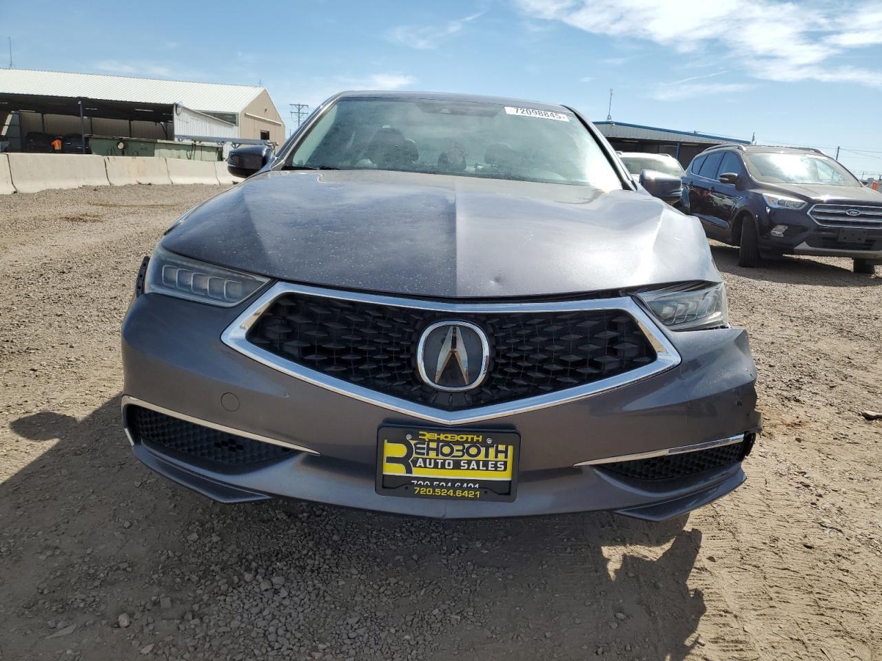 2018 Acura Tlx - Фото 5