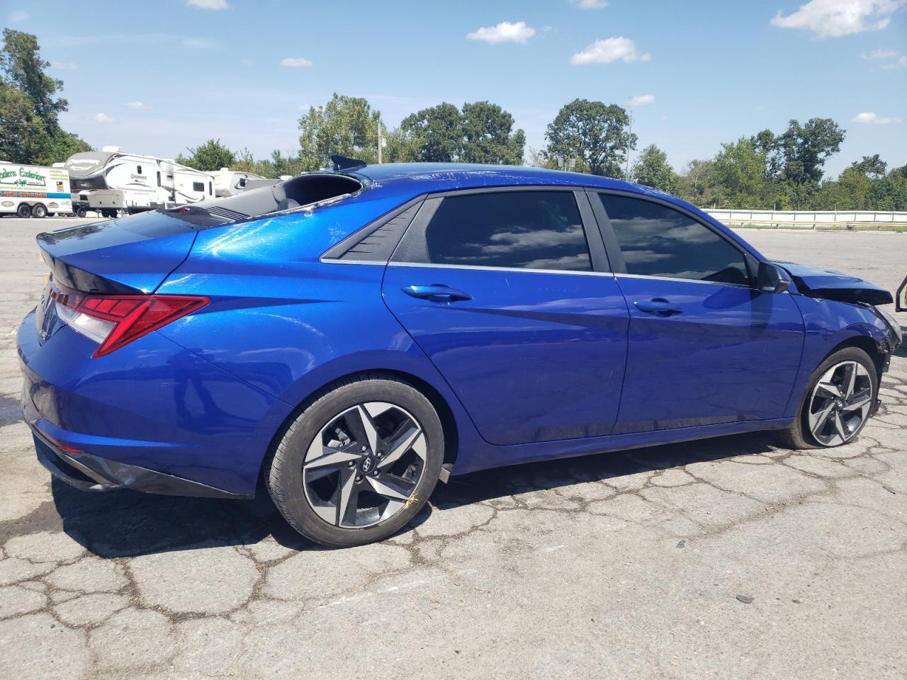 2023 Hyundai Elantra Limited - Image 3