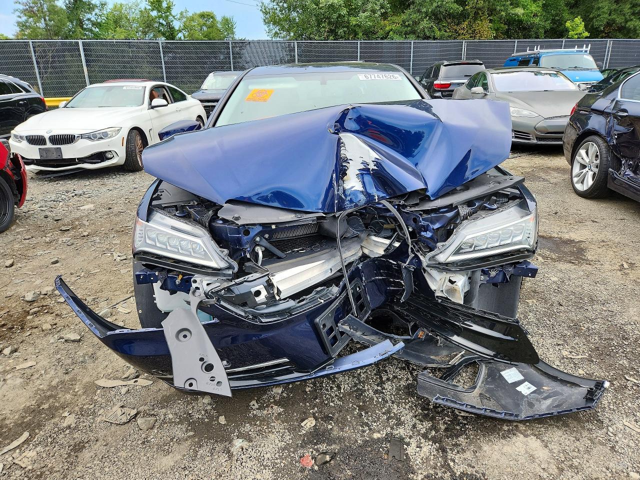 2017 Acura Tlx - Фото 5