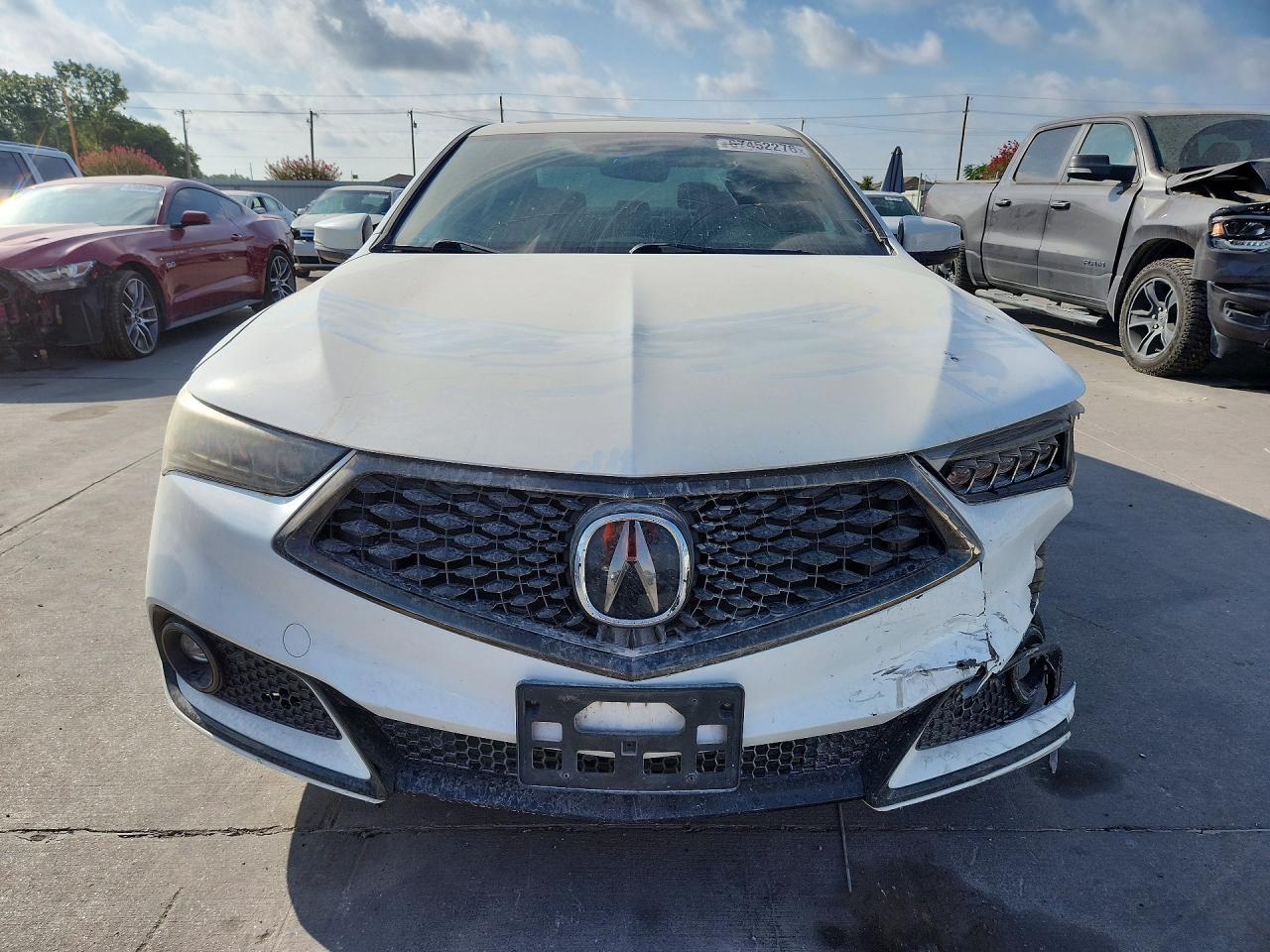 2018 Acura Tlx Tech A-Spec Pkgs - Image 5