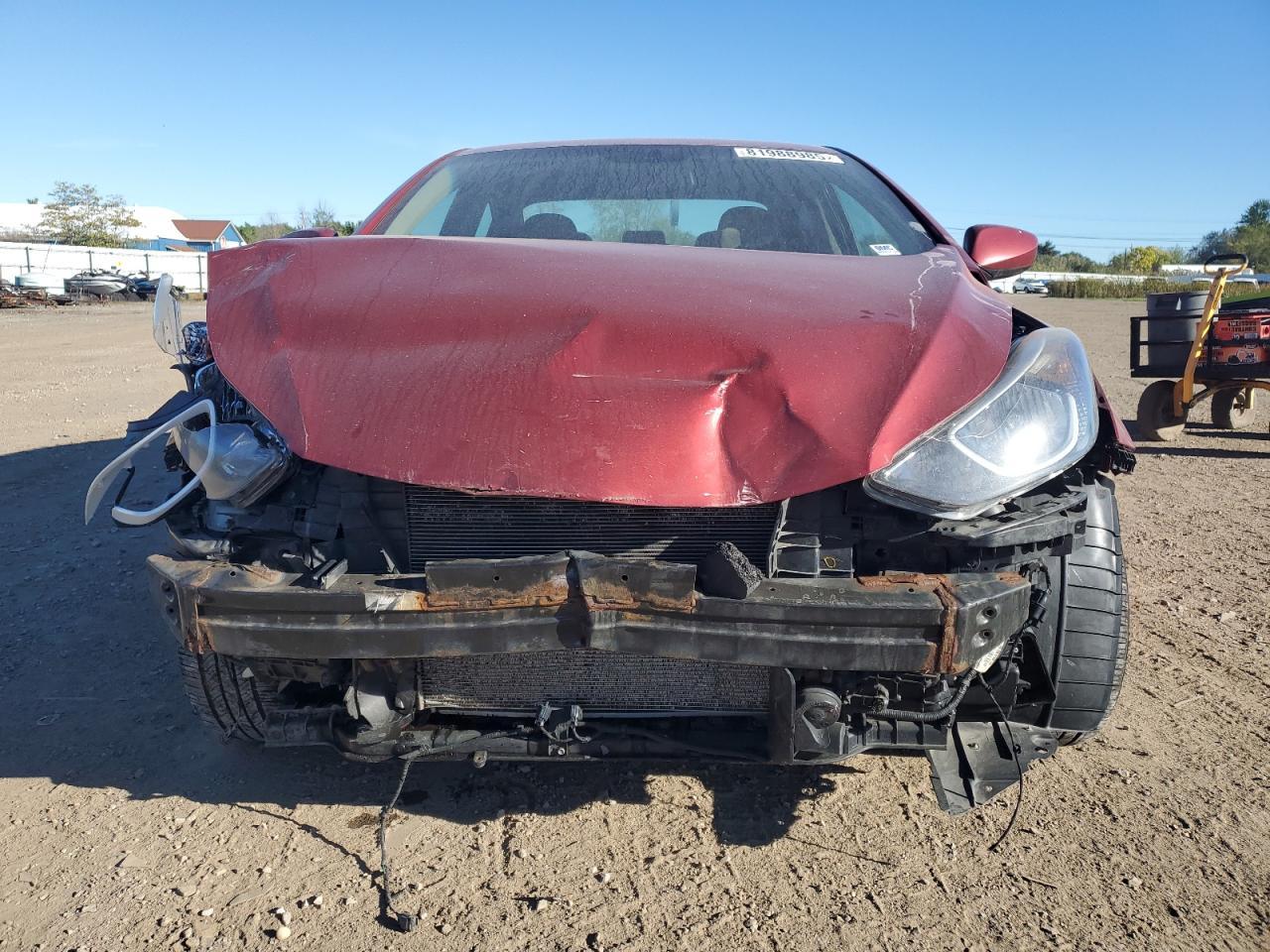 2015 Hyundai Elantra Se - Image 5